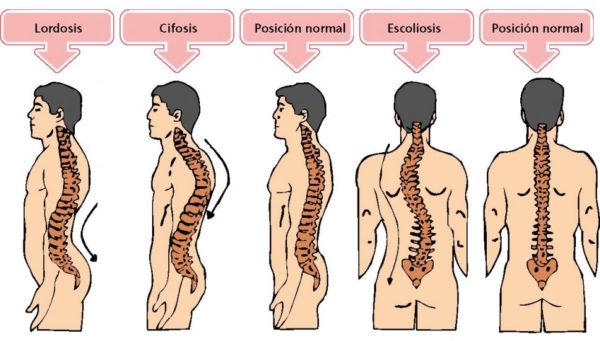 Anatom A De La Columna Vertebral I Curvaturas Barcelona Quiropractic