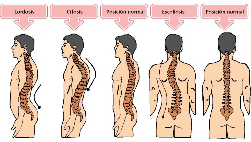 Anatomía de la columna vertebral (I). Curvaturas. - Barcelona